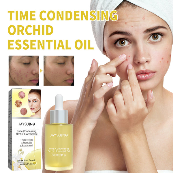 Orchid Acne Treatment Oil Cleansing And Brightening